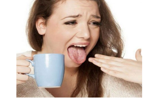 तातोले जिब्रो पाेल्यो ? तत्कालै यसरी ठिक गर्न सकिन्छ