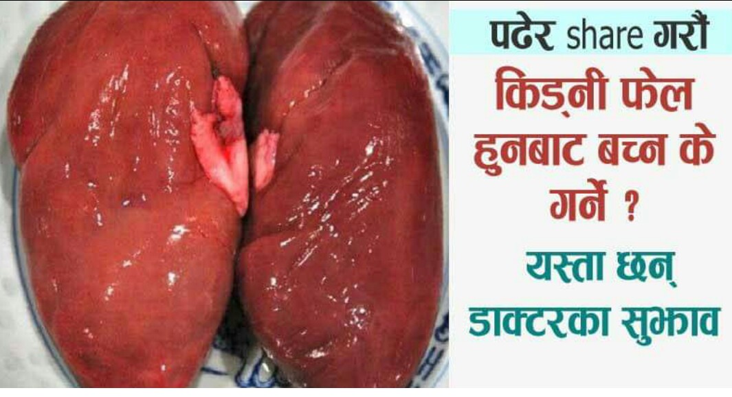 किड्नी फेल कसरी हुन्छ ? किड्नी सम्वन्धि यी ७ महत्वपूर्ण जानकारीहरु हरेकले जानिराखौं !