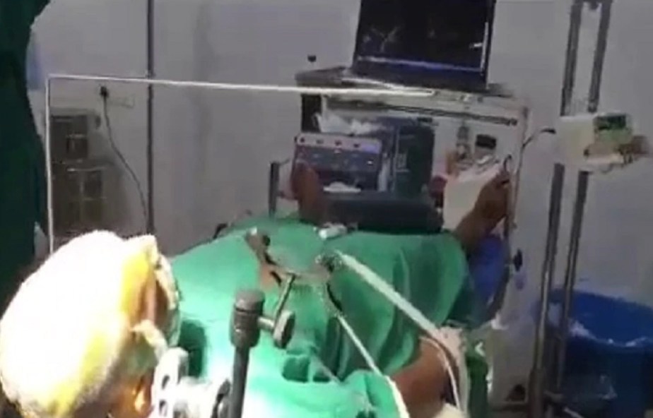 अनौठो उपचार! बिरामीलाई अंग्रेजी फिल्म र मनपर्ने टिभी शो देखाउँदै गरियो टाउकोको शल्यकृया