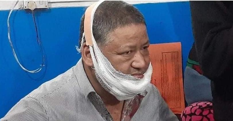 बुटवलको मतगणनास्थलमै पौडेल पक्षका उम्मेदवार कुटिए