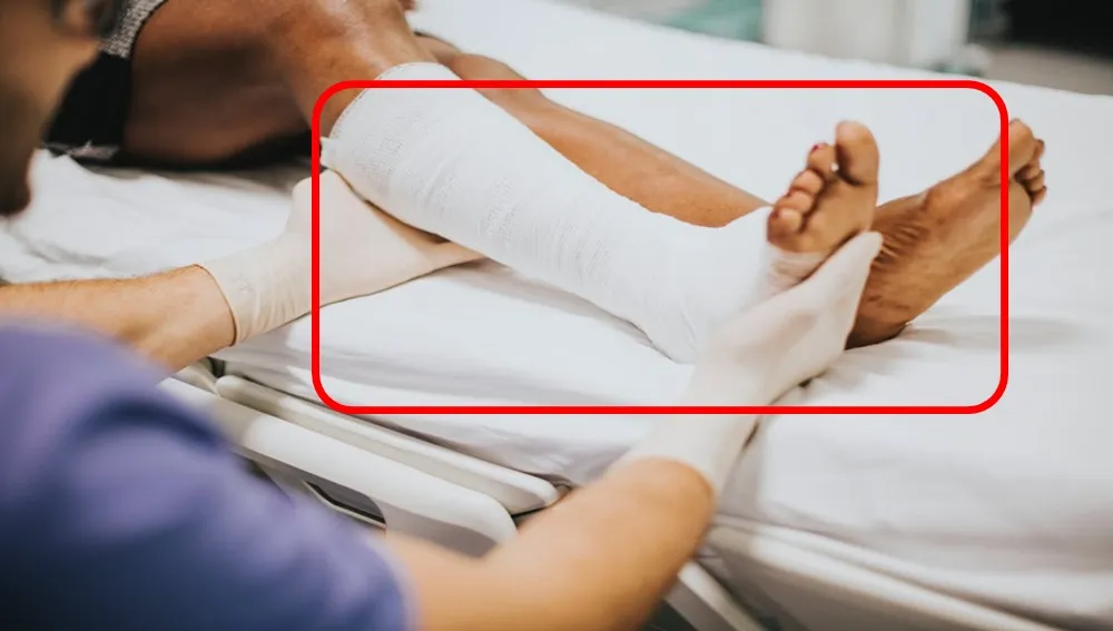 डाक्टरले बिरामीको अर्को खुट्टा शल्यक्रिया गर्नुपर्ने अर्कै खुट्टाको शल्यक्रिया गरिदिएपछि !