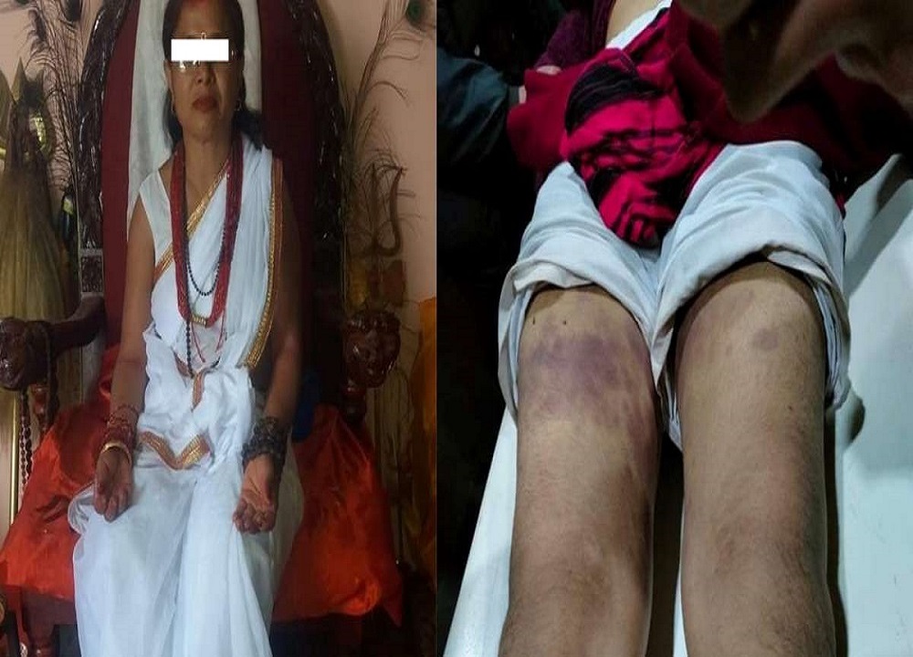 निको पार्छु भनेर लगेको १४ वर्षीया बालिका रोशनीलाई जब झाँक्रीको कुटपिट गरेपछि....